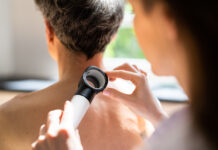 “MelaNOmás”: decirle no más al melanoma, depende de vos